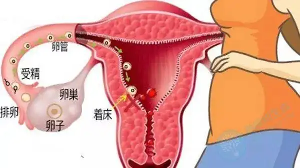 做胚胎移植手术需要多少钱